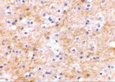 Anti-SAPAP3 antibody used in IHC (Paraffin sections) (IHC-P). GTX85421