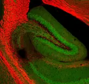 Anti-Myelin basic protein antibody used in Immunohistochemistry (IHC). GTX85456