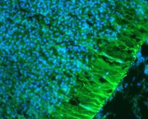 Anti-Nestin antibody used in Immunohistochemistry (IHC). GTX85457