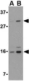 Anti-DRAM antibody used in Western Blot (WB). GTX85484