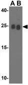 Anti-RPA Interacting Protein antibody used in Western Blot (WB). GTX85485