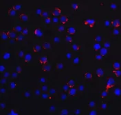 Anti-DDX58 antibody used in Immunocytochemistry/ Immunofluorescence (ICC/IF). GTX85488