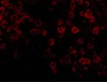 Anti-TIP47 antibody used in IHC (Paraffin sections) (IHC-P). GTX85492