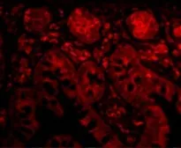 Anti-PTRH2 antibody used in IHC (Paraffin sections) (IHC-P). GTX85497