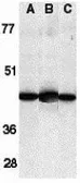 Anti-Caspase 13 antibody used in Western Blot (WB). GTX85523