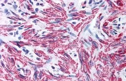 Anti-Myosin Light Chain 2 antibody used in IHC (Paraffin sections) (IHC-P). GTX85778