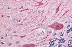 Anti-Syntaxin 2 antibody used in IHC (Paraffin sections) (IHC-P). GTX85883