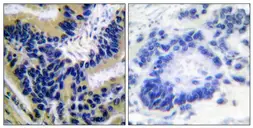 Anti-Caspase 3 (cleaved Asp175) antibody used in IHC (Paraffin sections) (IHC-P). GTX86909