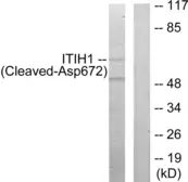 Anti-ITIH1 (cleaved Asp672) antibody used in Western Blot (WB). GTX86920