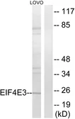 Anti-EIF4E3 antibody used in Western Blot (WB). GTX86964