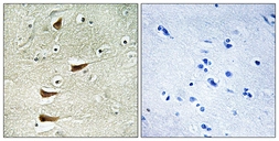 Anti-MLK2 antibody used in IHC (Paraffin sections) (IHC-P). GTX86985