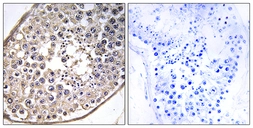 Anti-DNAL4 antibody used in IHC (Paraffin sections) (IHC-P). GTX86991