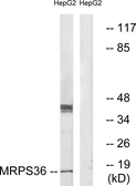 Anti-MRPS36 antibody used in Western Blot (WB). GTX87009