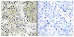 Anti-ANO9 antibody used in IHC (Paraffin sections) (IHC-P). GTX87030