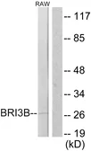 Anti-BRI3B antibody used in Western Blot (WB). GTX87070