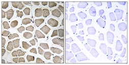 Anti-MCT12 antibody used in IHC (Paraffin sections) (IHC-P). GTX87072