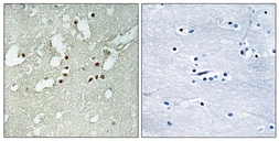 Anti-FOXJ3 antibody used in IHC (Paraffin sections) (IHC-P). GTX87156