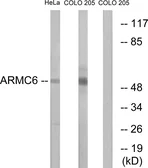 Anti-ARMC6 antibody used in Western Blot (WB). GTX87183