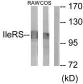 Anti-IARS2 antibody used in Western Blot (WB). GTX87187