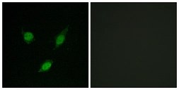 Anti-TACC1 antibody used in Immunocytochemistry/ Immunofluorescence (ICC/IF). GTX87189