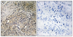 Anti-A26C2 + A26C3 antibody used in IHC (Paraffin sections) (IHC-P). GTX87210