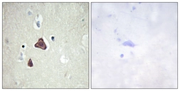 Anti-ADCY8 antibody used in IHC (Paraffin sections) (IHC-P). GTX87216
