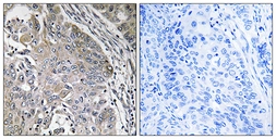 Anti-SPINK6 antibody used in IHC (Paraffin sections) (IHC-P). GTX87230