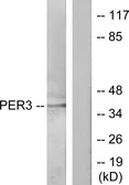 Anti-PER3 antibody used in Western Blot (WB). GTX87243