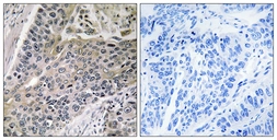 Anti-MRPS7 antibody used in IHC (Paraffin sections) (IHC-P). GTX87261