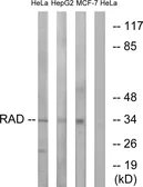 Anti-RAD antibody used in Western Blot (WB). GTX87282