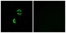 Anti-LDLRAD3 antibody used in Immunocytochemistry/ Immunofluorescence (ICC/IF). GTX87322