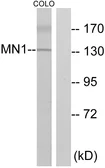 Anti-MN1 antibody used in Western Blot (WB). GTX87328