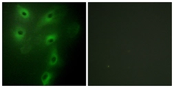 Anti-TRIM59 antibody used in Immunocytochemistry/ Immunofluorescence (ICC/IF). GTX87419