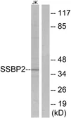 Anti-SSBP2 antibody used in Western Blot (WB). GTX87442