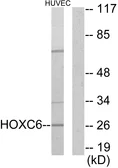 Anti-HOXC6 antibody used in Western Blot (WB). GTX87445
