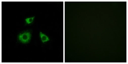 Anti-MRPL52 antibody used in Immunocytochemistry/ Immunofluorescence (ICC/IF). GTX87484