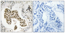 Anti-PMS2/PMS2CL antibody used in IHC (Paraffin sections) (IHC-P). GTX87509