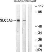 Anti-SLC5A6 antibody used in Western Blot (WB). GTX87516