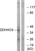 Anti-ZDHHC9 antibody used in Western Blot (WB). GTX87571