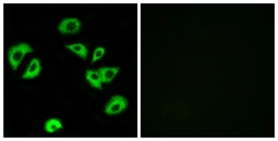Anti-LILRB4 antibody used in Immunocytochemistry/ Immunofluorescence (ICC/IF). GTX87582