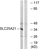 Anti-SLC25A21 antibody used in Western Blot (WB). GTX87583