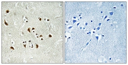 Anti-GCP6 antibody used in IHC (Paraffin sections) (IHC-P). GTX87629