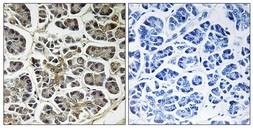 Anti-ATP5G2 antibody used in IHC (Paraffin sections) (IHC-P). GTX87662