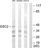 Anti-GSC2 antibody used in Western Blot (WB). GTX87710