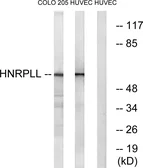 Anti-HNRPLL antibody used in Western Blot (WB). GTX87711