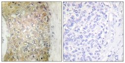 Anti-Hsp20 antibody used in IHC (Paraffin sections) (IHC-P). GTX87716