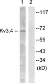 Anti-KCNC4 antibody used in Western Blot (WB). GTX87719