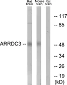 Anti-ARRDC3 antibody used in Western Blot (WB). GTX87776