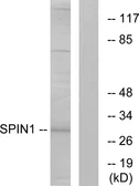 Anti-SPIN1 antibody used in Western Blot (WB). GTX87781