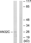 Anti-ANP32C antibody used in Western Blot (WB). GTX87819